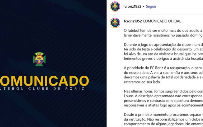 Jogador do FC Roriz foi agredido com um chute no rosto e sofreu fraturas graves