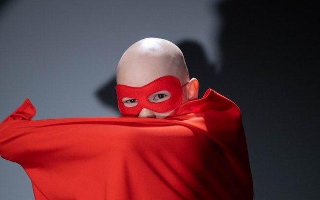 Alopecia areata atinge 1% dos brasileiros