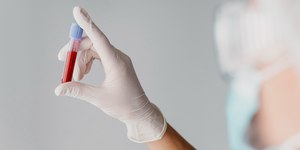 Mitos e verdades sobre a transmissão de hepatites virais