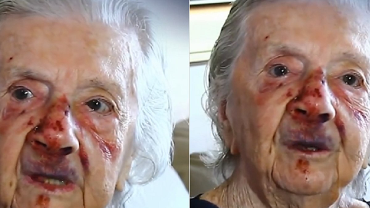A idosa, que é costureira aposentada, foi empurrada durante a ação e sofreu ferimentos no rosto A idosa, que é costureira aposentada, foi empurrada durante a ação e sofreu ferimentos no rosto
