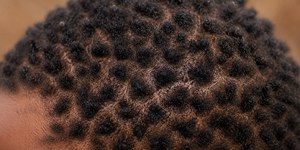 O cabelo raro africano que parece feito de “pontos”