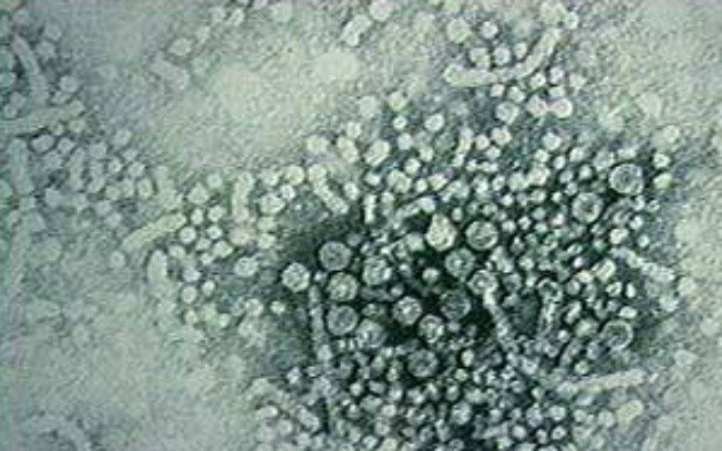 Vírus da hepatite B
