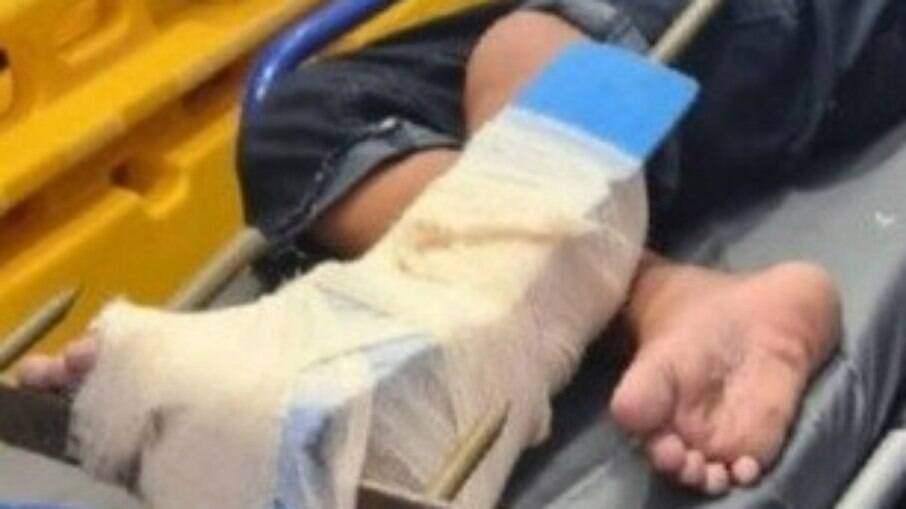 Lança atravessou pé de menino de 12 anos em Manaus 