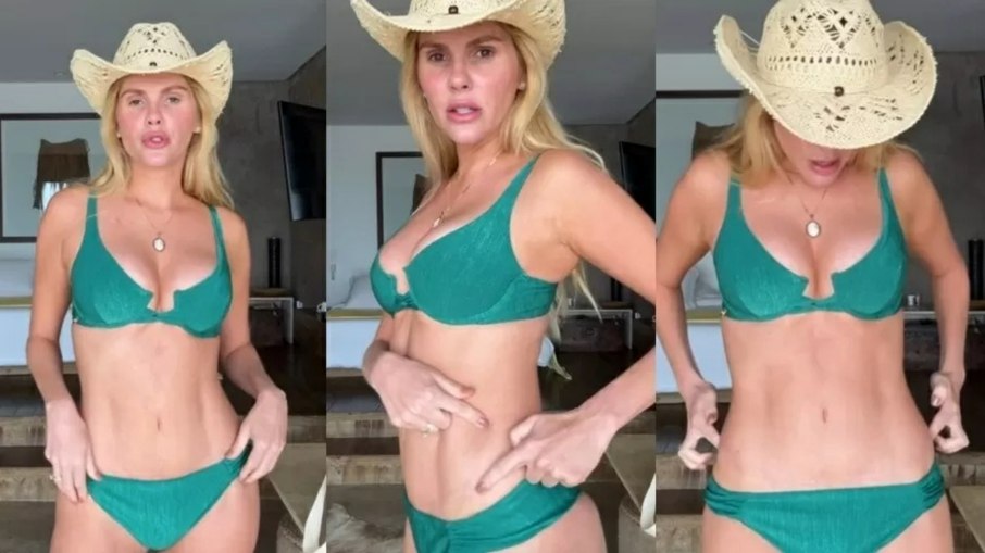 Bárbara Evans mostra marca de cirurgia nas redes sociais