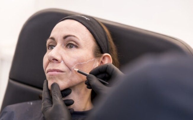 Mais colágeno e elastina: quais produtos e procedimentos ajudam a preservar essas proteínas tão preciosas para a pele?