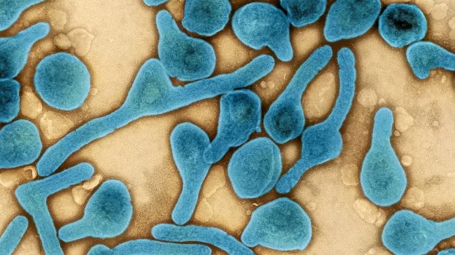 Micrografia eletrônica de transmissão colorida de partículas do vírus Marburg (azul)