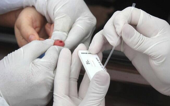 Implementação de testes para familiares de infectados por Covid-19 começa segunda (13)