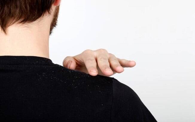 Dermatite seborreica: 40% da população será acometida pela doença, diz pesquisa