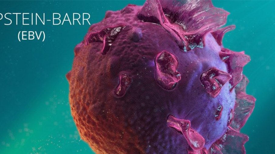 Pesquisadores avaliam associação muito forte entre a infecção pelo vírus Epstein-Barr (EBV) e o desenvolvimento da esclerose múltipla Pesquisadores avaliam associação muito forte entre a infecção pelo vírus Epstein-Barr (EBV) e o desenvolvimento da esclerose múltipla