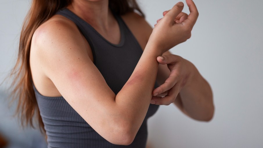 Alergia de pele