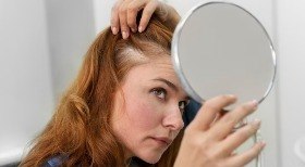 Como lidar com a queda de cabelo na menopausa? Veja tratamento