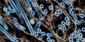 México registra primeira morte por gripe aviária H5N1
