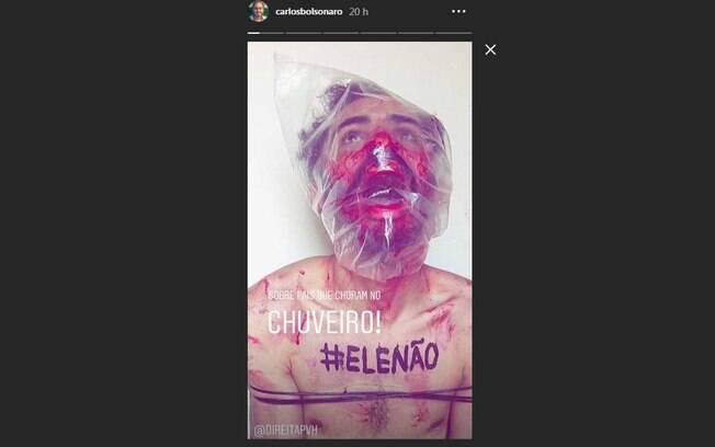 Filho de Bolsonaro divulgou foto com simulação de tortura para ridicularizar atos contra seu pai