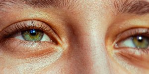 Olheiras e marcas de expressão podem ser sinais de desgaste dos dentes