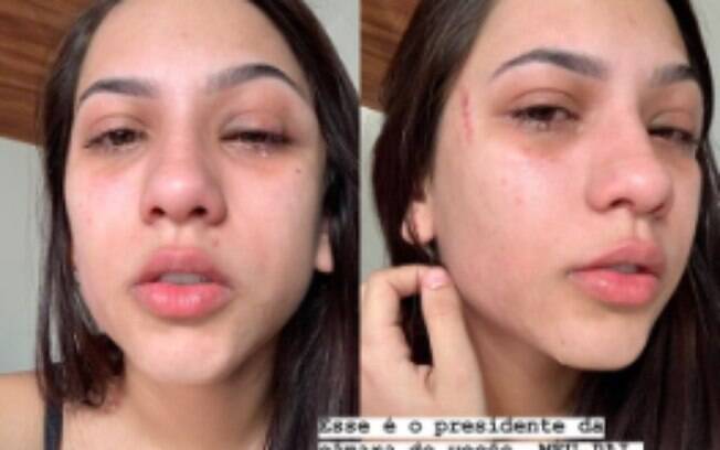 Rafaella fez postagens no instagram denunciando a suposta agressão cometida pelo pai