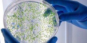 Superbactérias são achadas em aves silvestres em Santos (SP)