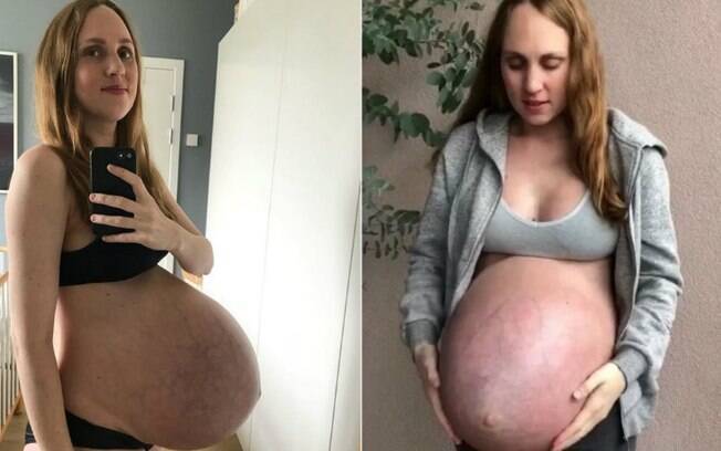 A barriga de grávida de uma mãe norueguesa de trigêmeos está chamando atenção no Instagram por ser muito grande