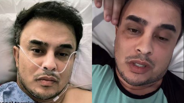 Kauan, dupla de Matheus, faz cirurgia de emergência após dores em show