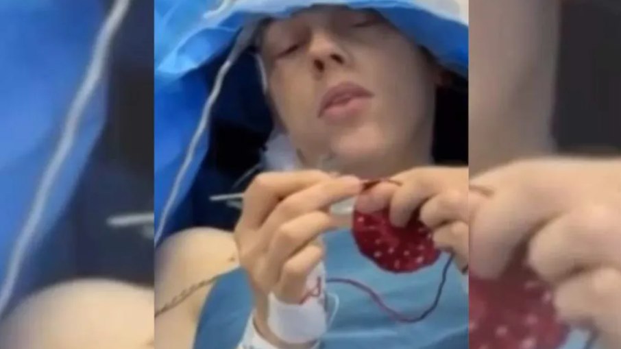 Paciente permanece acordada e faz crochê durante cirurgia no cérebro, procedimento que permite aos médicos monitorar funções essenciais em tempo real. Paciente permanece acordada e faz crochê durante cirurgia no cérebro, procedimento que permite aos médicos monitorar funções essenciais em tempo real.