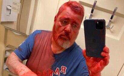 Nobel da Paz de 2021 é agredido em trem na Rússia