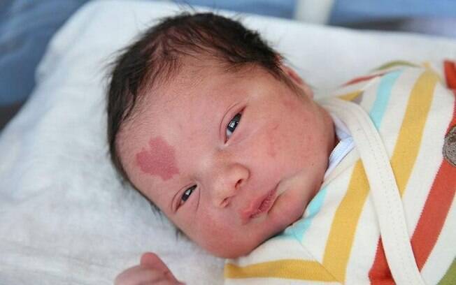 Este bebê está conquistando todos com sua marca de nascença em formato de coração