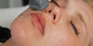 Aos 27 anos, Virginia faz procedimento para rejuvenescer o rosto
