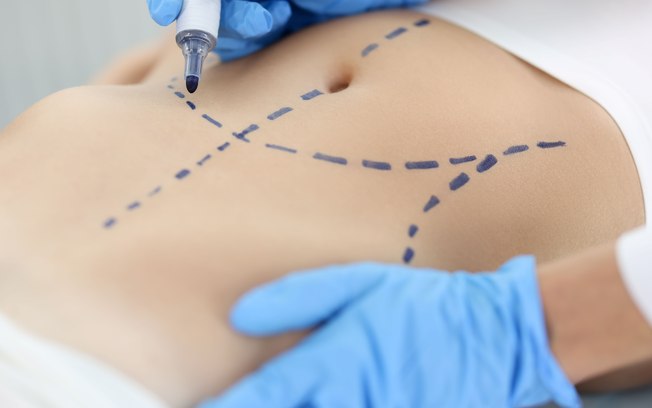 Cirurgia plástica: busca por resultados naturais é tendência Cirurgia plástica: busca por resultados naturais é tendência