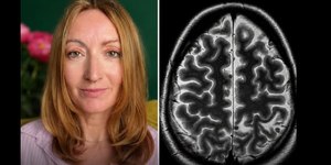 Britânica descobre 38 parasitas alojados no cérebro após viagem