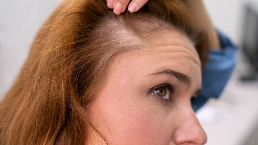 Dermatologista esclarece mitos e verdades sobre cabelos brancos