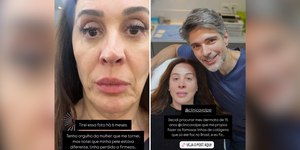 Claudia Raia exibe transformação após procedimento estético
