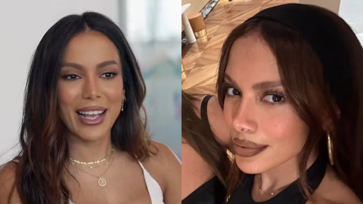 Anitta surpreende fãs ao debutar 'novo rosto' após infecção