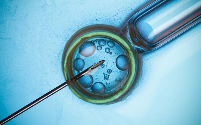 A fertilização in vitro em mulheres com mais de 40 anos significou um aumento de risco de câncer de mama