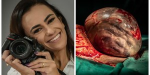 Fotógrafa se especializou em partos empelicados e ganhou prêmios