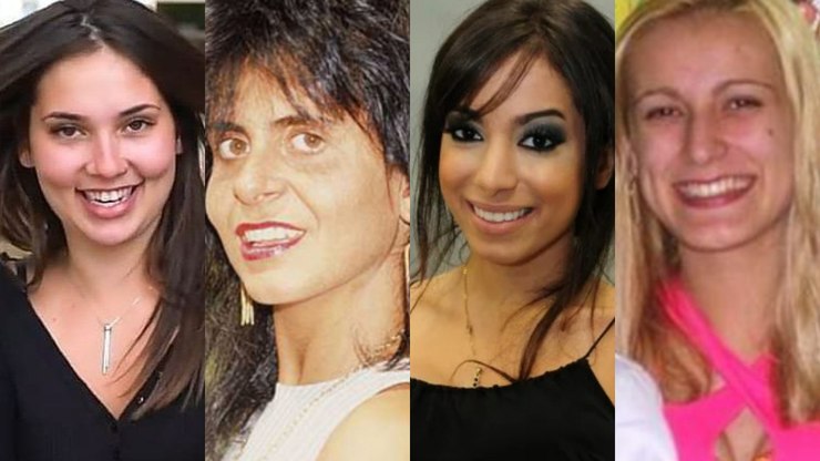 Antes e depois: Virginia, Anitta, Gretchen e Andressa Urach