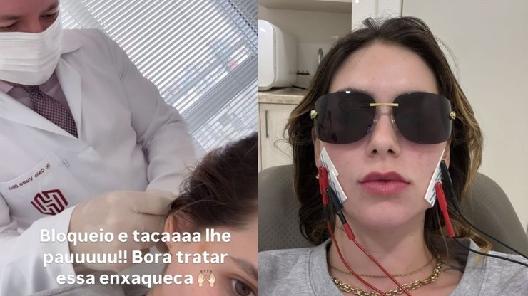 Botox na cabeça? Entenda procedimento feito por Virgínia Fonseca