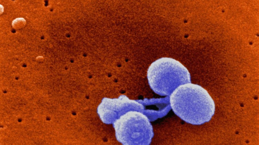 Imagem de microscópio eletrônico da Streptococcus pneumoniae: velocidade de mutação genética surpreendeu os cientistas
