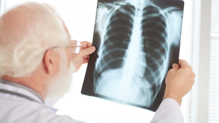 Pneumonia silenciosa: o perigo por trás da doença 