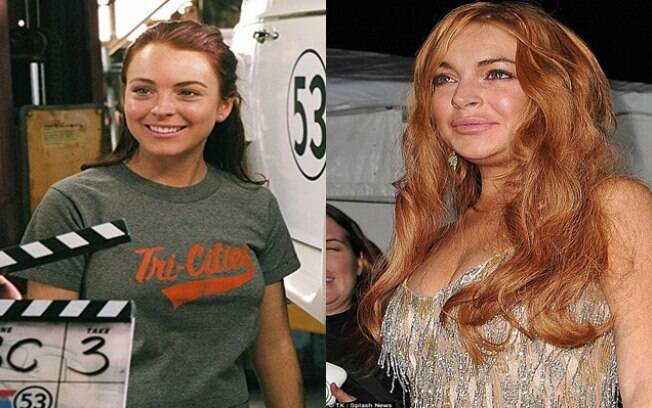 Antes e depois de Lindsay Lohan aplicar botox
