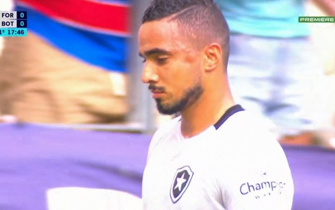 Rafael, do Botafogo, sofre afundamento na face em partida contra o Fortaleza