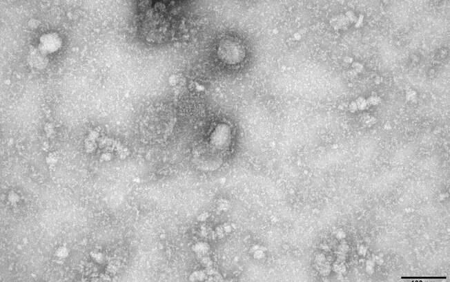 Novos casos de coronavírus foram notificados em cruzeiro