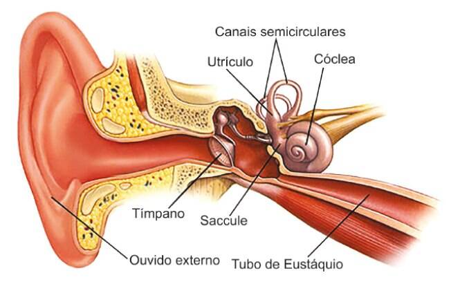 A doença é um distúrbio do ouvido interno que pode levar a tonturas (vertigens) e perda auditiva. Na maioria dos casos, ela afeta apenas um ouvido