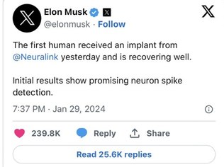 Elon Musk divulgou o primeiro implante feito pela Neuralink em humano