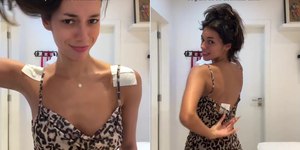 Alô Virginia! Alane posta vídeo de machucado no ombro pós desfile