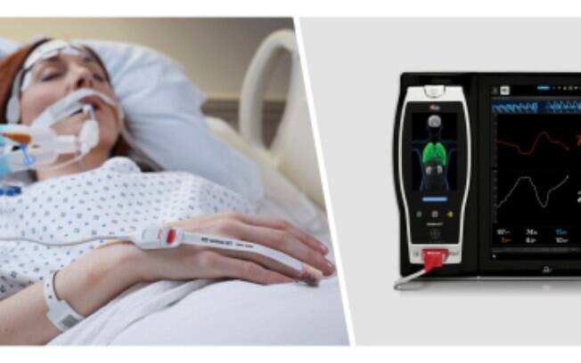 Estudo comparando dois indicadores não invasivos da resposta a fluidos em pacientes ventilados mecanicamente descobre a eficácia e as vantagens do Masimo PVi®