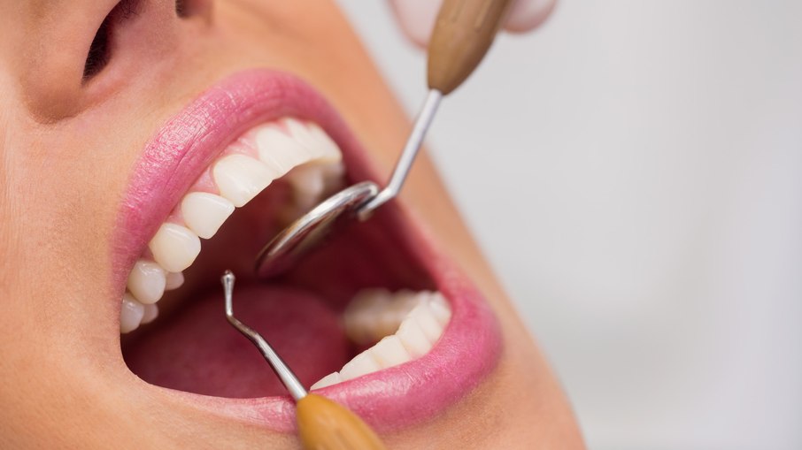 Dentes Dentes