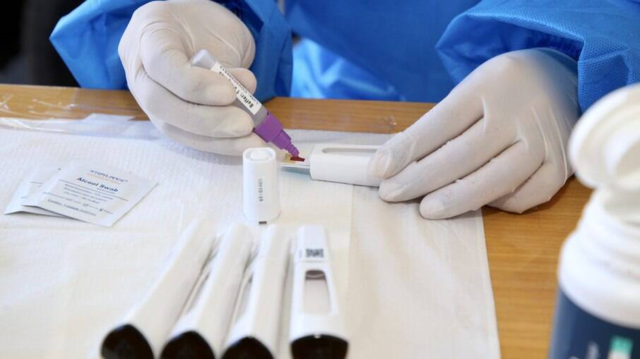  Secretaria Municipal da Saúde (SMS) disponibilizou 150 mil testes rápidos para o diagnóstico de influenza A e B e 300 mil testes rápidos de antígeno para covid-19
