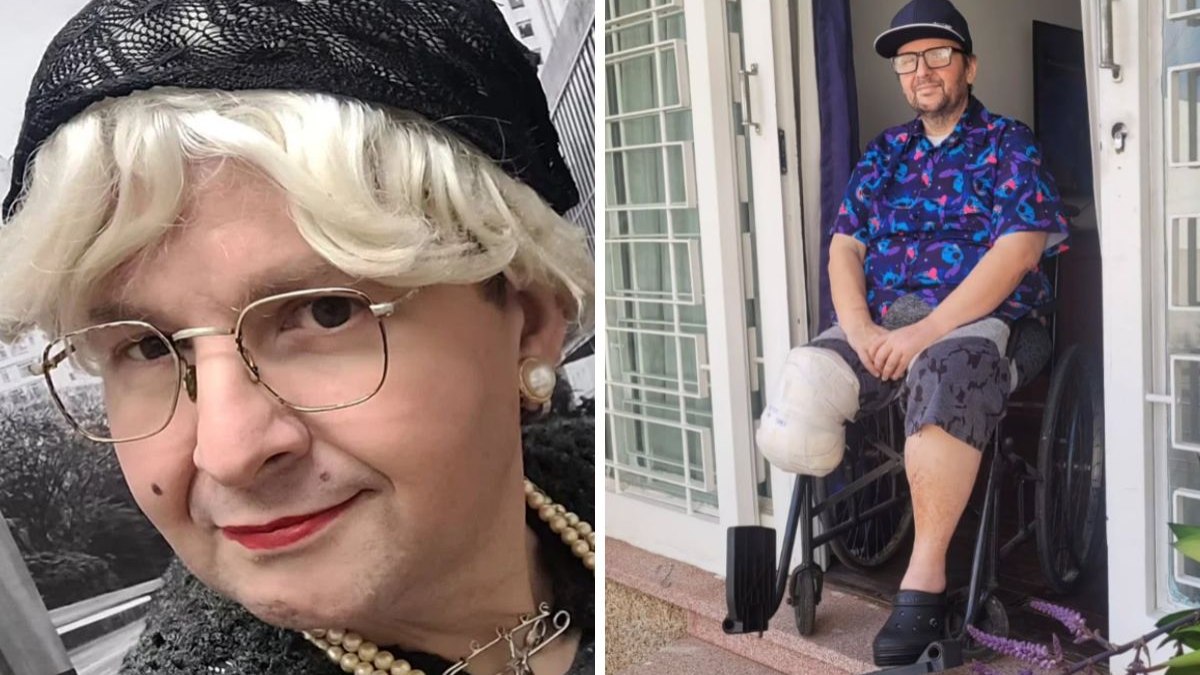 Ex-'A Praça é Nossa' tem o pé amputado após infecção causada por diabetes Ex-'A Praça é Nossa' tem o pé amputado após infecção causada por diabetes