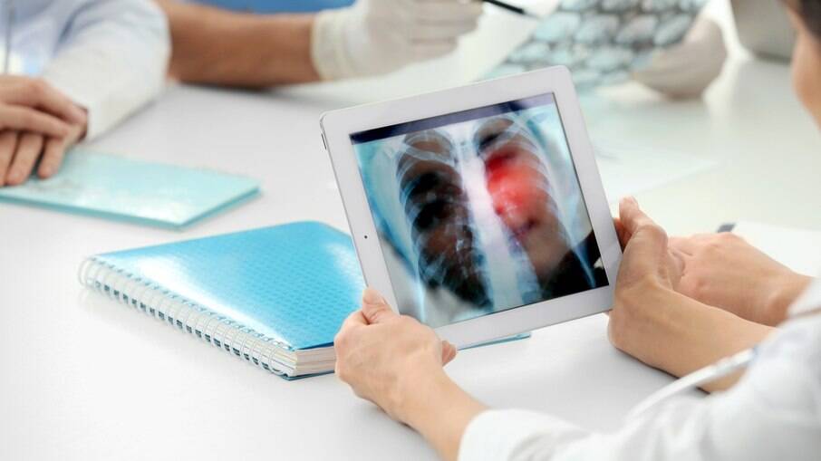 Anvisa aprova tratamento inédito para câncer de pulmão inicial