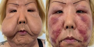 Juju do Pix: conheça a influenciadora que teve o rosto deformado