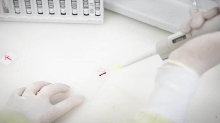 Exames revelam doença em paciente com suspeita de Ebola no Rio